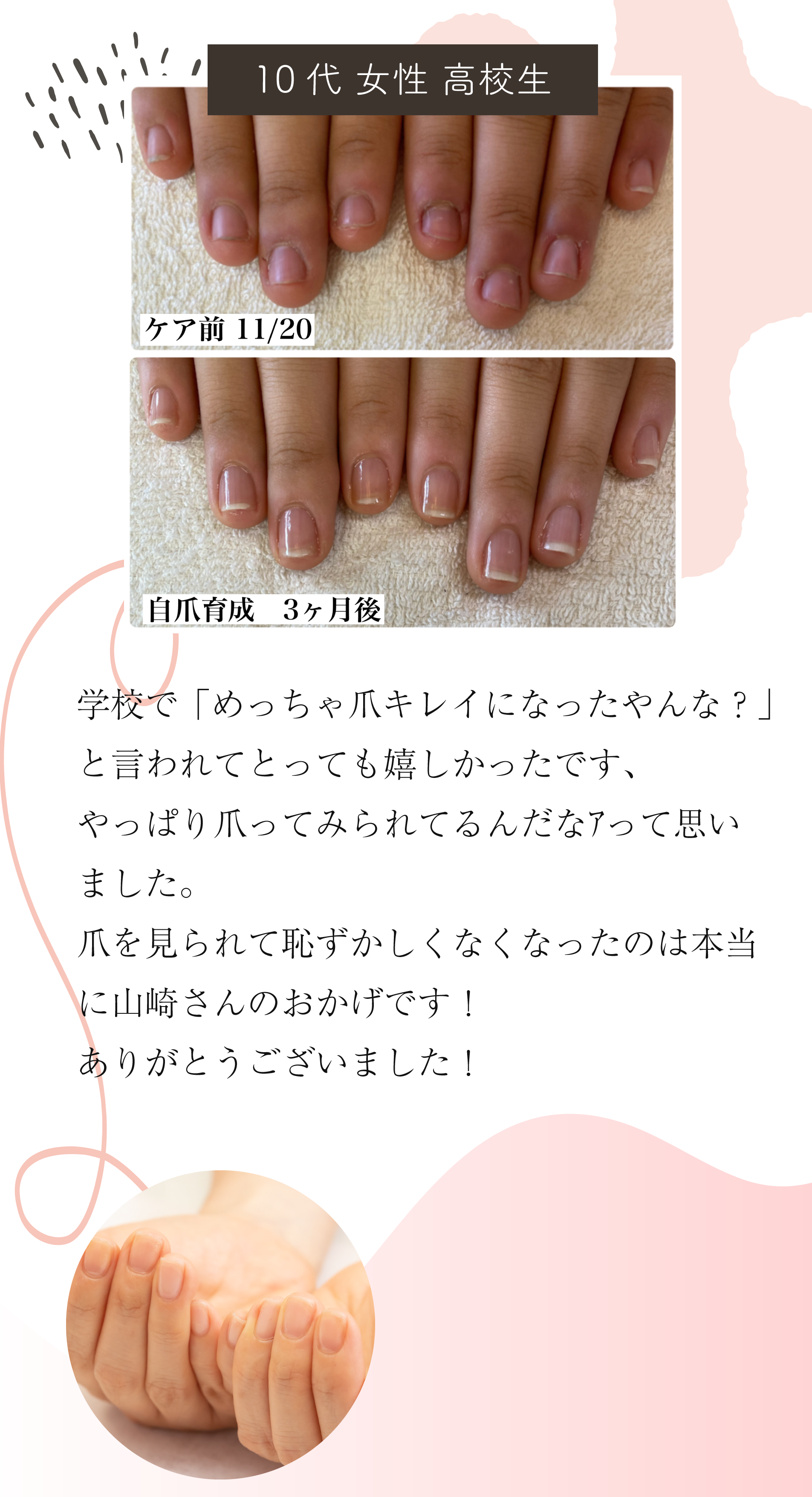 自爪育成の症例